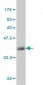 MUC5AC Antibody (monoclonal) (M07)